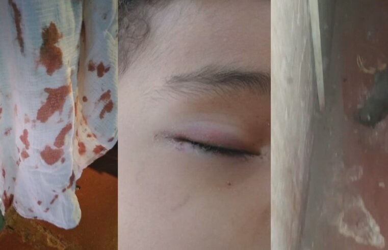 Criança fica ferida no rosto após ser atacada por rato enquanto dormia no DF