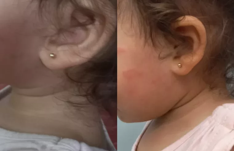 Professora que agrediu criança de um ano em SP disse que estava brincando: ‘Tremenda pisada de bola’