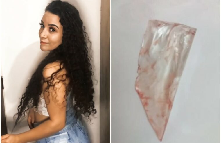 Jovem fica um mês com vidro de 5 cm enterrado nas costas em SP e médicos não percebem