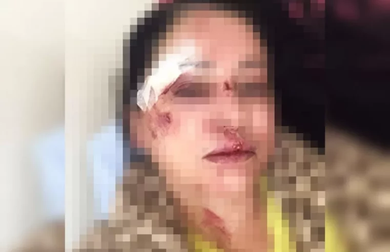 Moradora de Palmital diz que foi agredida por nove vizinhos por acharem que ela havia denunciado som alto à polícia