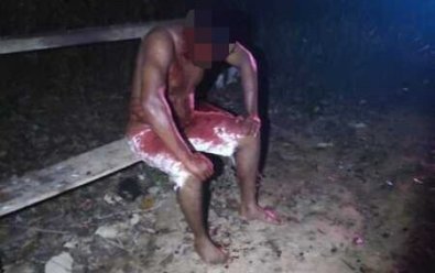 Homem bate na namorada e acaba espancado em Cuiabá