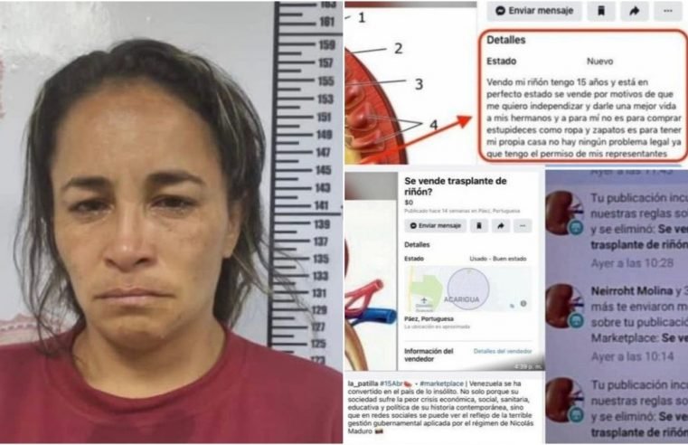 Mulher é presa na Venezuela suspeita de anunciar rins humanos no Facebook por R$ 94 mil