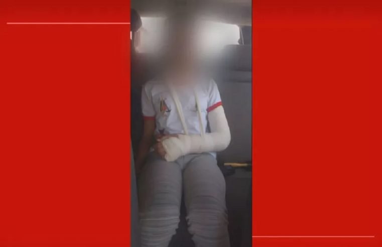 Mulher quebra braço de menina de 11 anos após achar que criança estava rindo dela