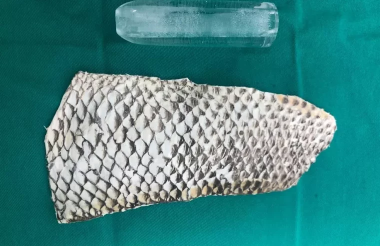 Pele de tilápia é utilizada para construir canal vaginal em mulher com síndrome rara