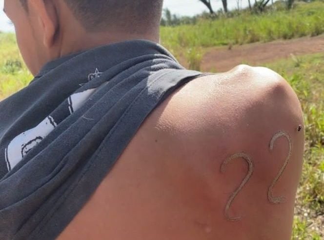 Jovem usa ferro de marcar gado para tatuar o 22 de Bolsonaro em MT