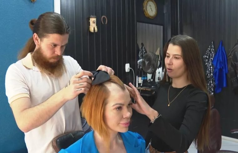 Corte de cabelo que imita calvície vira sucesso