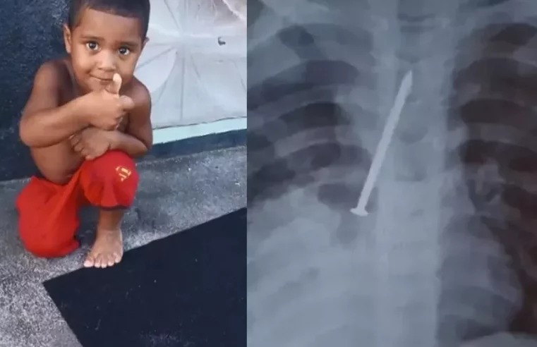 Menino morre após passar 1 ano com prego no pulmão na Bahia; família acusa hospital de negligência