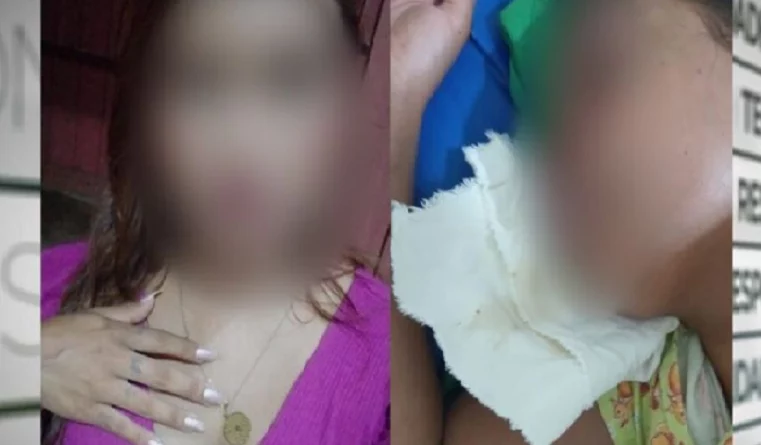 Garçonete entra em coma após ser espancada por cliente no PA