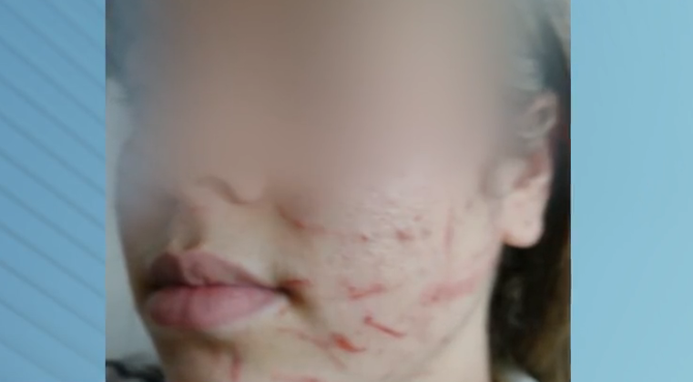 Adolescente se envolve em briga após sofrer bullying e é suspensa por 30 dias em escola de SP
