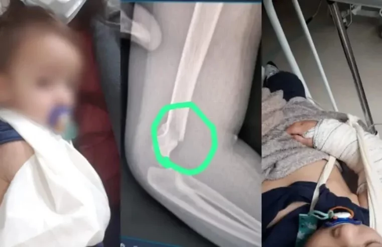 Professora é acusada de quebrar braço de criança em creche de Pinhais