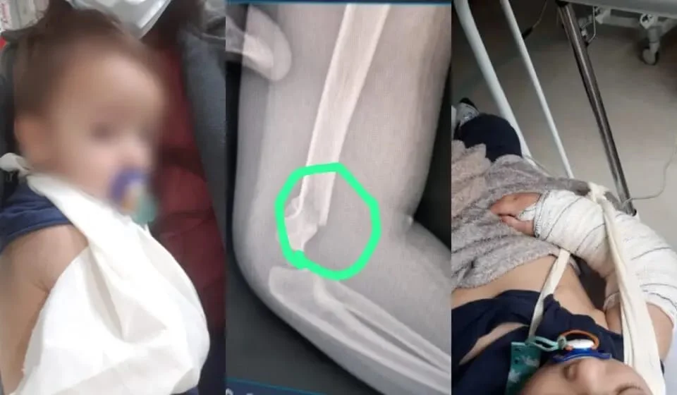 Professora é acusada de quebrar braço de criança em creche de Pinhais