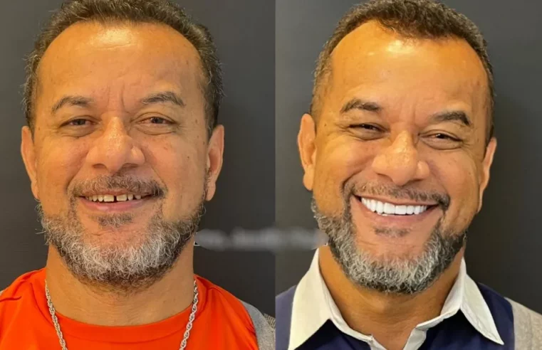 Funcionário público morre após ter infecção generalizada depois de colocar facetas dentárias, diz família