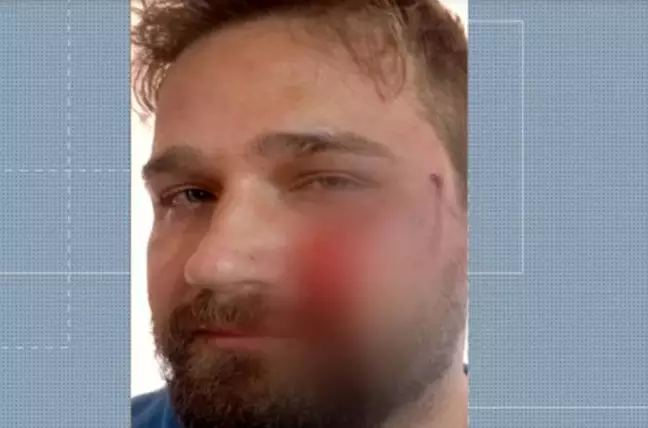 Médico é agredido com capacete após negar atestado de 3 dias para adolescente