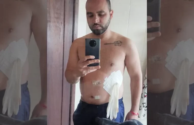 Médico coloca luva cirúrgica no lugar de bolsa de colostomia em paciente: ‘Falou que era medicina de guerra’