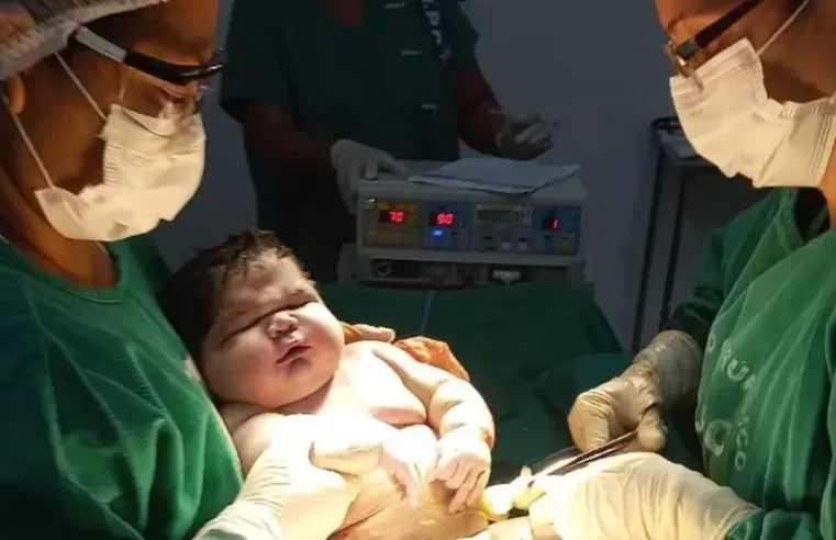 Bebê nasce com mais de 7 kg e bate recorde no Amazonas