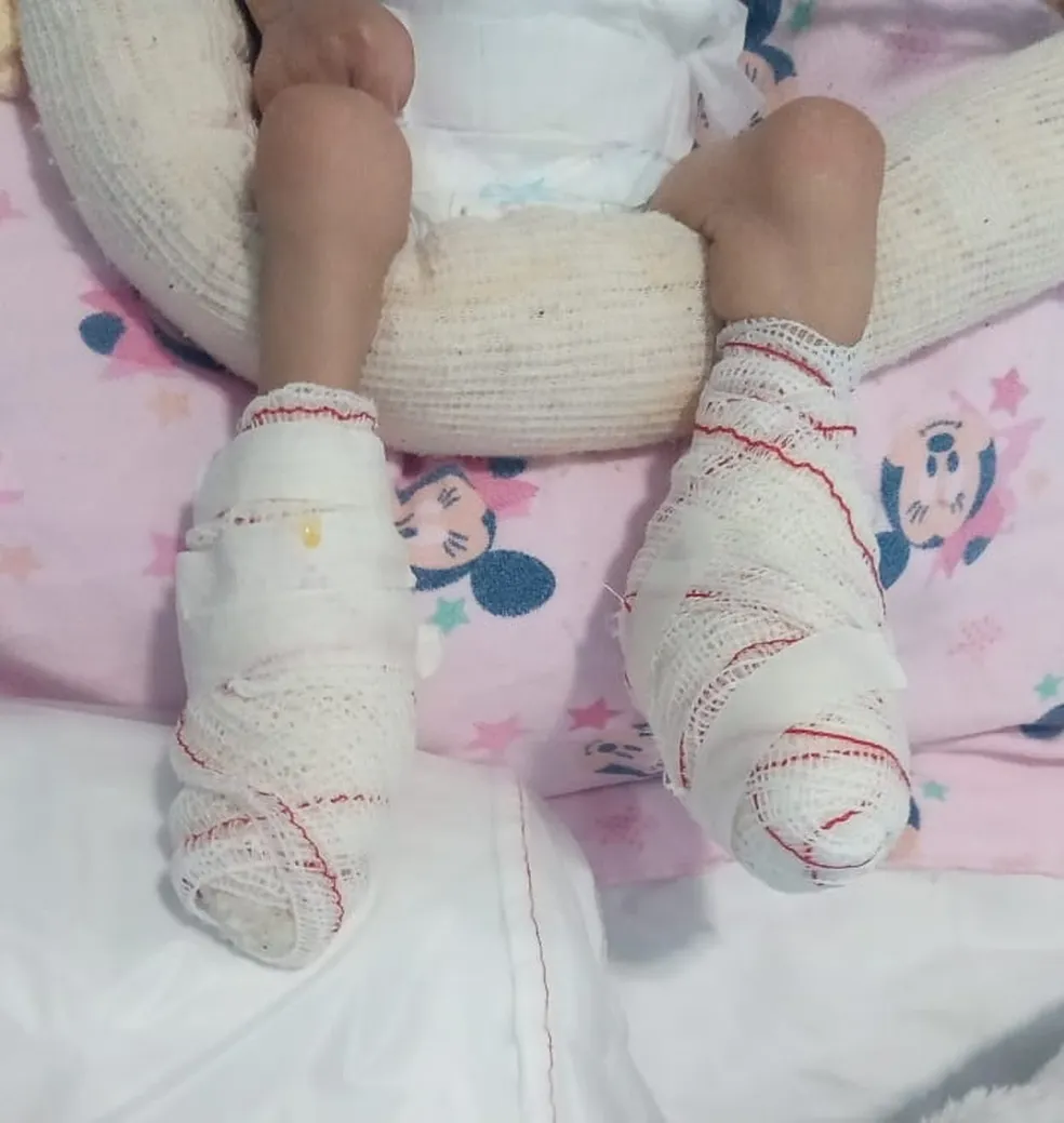 Coren-SP vai investigar conduta de enfermeiros após hospital esquecer aquecedor ligado e queimar pés de bebê em Jacareí