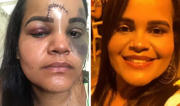 Professora acusa diretora por tentativa de homicídio na BA